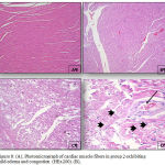 Figure 8: (A), Photomicrograph of cardiac muscle fibers in group 2 exhibiting mild edema and congestion (HEx200). (B),