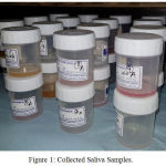 Figure 1: Collected Saliva Samples.