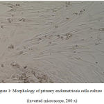 Figure 1: Morphology of primary endometriosis cells culture (inverted microscope, 200 x).