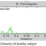 Figure 2: Power Spectral Density of healthy subject.