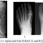 Figure 3.1: Spine and Feet X-RAY (L and R) [14, 15]
