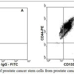 Figure 2: Isolation of prostate cancer stem cells from prostate cancer tissues: