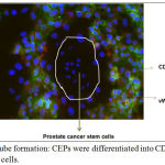 Figure 4: Endothelial tube formation: CEPs were differentiated into CD31 and vWF expressing endothelial cells.