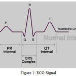 Figure 1: ECG Signal.