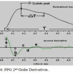 Figure 6: PPG 2nd Order Derivatives.