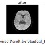 Figure 13: Denoised Result for Stanford_Hardi (N=4).