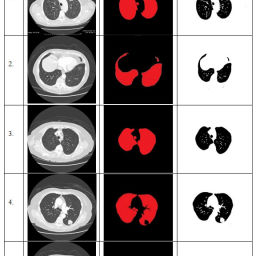 Segmentation of Lung Images using Region Based Neural Networks ...