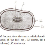 Figure 1: Cross section of the root show the area at which the microhardness of root canal dentin measured., L: Lumen of the root can , D: Dentin, H: area which the hardness measured(0.5mm from the lumen) , C: cementum