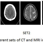 Figure 5: Different sets of CT and MRI images.