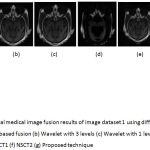 Figure 6: Multimodal medical image fusion results of image dataset 1 using different techniques (a) PCA based fusion (b) Wavelet with 3 levels (c) Wavelet with 1 level (d) Guided filter (e) NSCT1 (f) NSCT2 (g) Proposed technique.