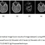 Figure 7: Multimodal medical image fusion results of image dataset 2 using different techniques (a) PCA based fusion (b) Wavelet with 3 levels (c) Wavelet with 1 level (d) Guided filter (e) NSCT1 (f) NSCT2 (g) Proposed technique