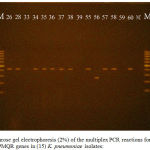 Figure 1: Agarose gel electrophoresis (2%) of the multiplex PCR reactions for detection of PMQR genes in (15) K. pneumoniae isolates: