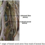 Figure 7: origin of lateral sacral artery from trunk of internal iliac artery.