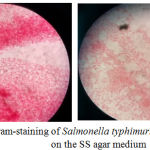 Figure 2: Gram-staining of Salmonella typhimurium colonies on the SS agar medium.