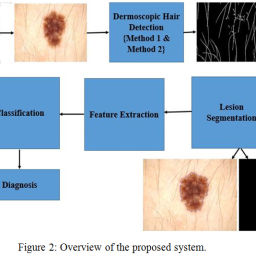 Melanoma Detection in Dermoscopic Images using Color Features ...