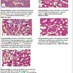 Figure 7: Hisptopathological sections in the kidney rat after treated with CC14 and treatment with leaves purified and flowers purified from Bauhinia variegate.