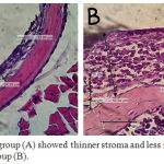 Figure 1: Treatment group (A) showed thinner stroma and less infiltration of cell imun than control group (B).