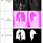 Figure 4: Coronal and Sagittal Chest CT Segmentation Results.