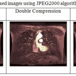 Table 7: Multiply compressed images using JPEG2000 algorithm.