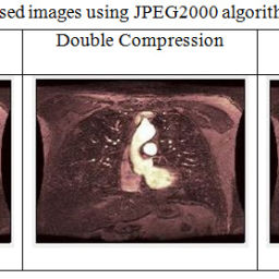 Multiple Image Compression in Medical Imaging Techniques using Wavelets ...