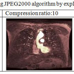 Table 8: Image Compression using JPEG2000 algorithm by explicitly giving compression ratio.