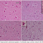 Figure 10: Representative photomicrographs of substantia nigra sections stained with Hx & E: