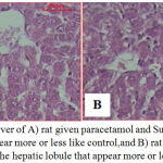Figure 3: Sections of liver of A) rat given paracetamol and Sum extract show the hepatic lobule that appear more or less like control,and B) rat given paracetamol and Sup extract show the hepatic lobule that appear more or less like control.