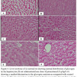 Figure 4: Liver sections of A) normal rat showing normal distribution of glycogen in the hepatocytes, B) rat administered one dose of paracetamol (3 g/kg/b.w) showing a marked diminution in the glycogen contents as compared with control group, C, D): rats giv