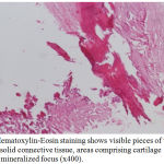 Figure 3: Hematoxylin-Eosin staining shows visible pieces of tissue containing solid connective tissue, areas comprising cartilage matrix and mineralized focus (x400).