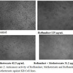 Figure 2: Anticancer activity of Roflumilast, Methotrexate and Roflumilast + Methotrexate against KB Cell lines.