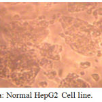Figure 1a: Normal HepG2 Cell line.