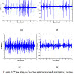 Figure 3: Wave shape of normal heart sound and murmur (a) normal heart sound (dataset 1) (b) normal heart sound (dataset 2) (c) Murmur (dataset 1) (d) Murmur (dataset 2).