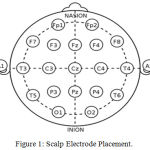 Figure 1: Scalp Electrode Placement.