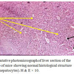 Figure 1: Representative photomicrograph of liver section of the first control group of mice showing normal histological structure of hepatic tissue (hepatocytes). H & E × 10.