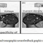 Figure 2: Traditional and tomographic neurofeedback graphic demonstration.6