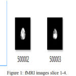 Figure 1: fMRI images slice 1-4.