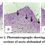 Figure 1: Photomicrographs showing histological sections of aorta abdominal of rats.