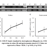 Figure 2: COX IV bands visualized by electrophoresis (Bluepads) (A). COX IV mRNA expressions in soleus (B) and gastrocnemius muscle (C). Values are expressed as Mean ± SEM. (*=p