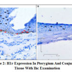 Figure 2: H1R Expression in Pterygium and Conjunctival Tissue with IHC Examination