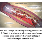 Figure 11: Design of a drug-eluting cardiac stent. A Stent is stationary whereas nano- burrs spread over scattered areas but target only damaged arterial wall.