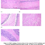 Figure 14: H&E staining of brain sections of rats exposed to Wi-Fi radiation and protected with BioGeometrical shapes group.