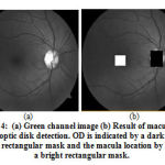 Figure 4: (a) Green channel image (b) Result of macula and optic disk detection. OD is indicated by a dark rectangular mask and the macula location by a bright rectangular mask.