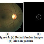 Figure 5: (a) Reinal fundus images (b) Motion pattern