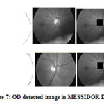Figure 7: OD detected image in MESSIDOR Dataset