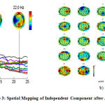 Figure 3: Spatial Mapping of Independent Component after Artifact Removal [20]