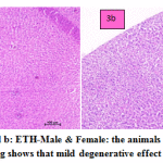 Figure 3a and b: ETH-Male & Female: the animals treated with ETH drug shows that mild degenerative effect of liver.