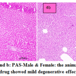 Figure 4a and b: PAS-Male & Female: the animals treated with PAS drug showed mild degenerative effect of liver.