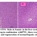 Figure 6a and b: ETH+PNS- Male & Female: in the liver section of the rats intoxicated with ETH drug in combination withPNS , there was rearrangement and regeneration of normal hepatic cells.