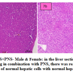 Figure 7a and b: PAS+PNS- Male & Female: in the liver section of the rats intoxicated with PAS drug in combination with PNS, there was rearrangement and regeneration of normal hepatic cells with normal hepatic parenchyma