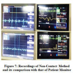 Figure 7: Recordings of Non-Contact Method and its comparison with that of Patient Monitor